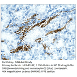 Anti-ErbB 4 Antibody from FabGennix (HER-401AP) - Antibodies.com