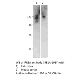 Anti-IRE1A Antibody from FabGennix (IRE1A-101Y) - Antibodies.com