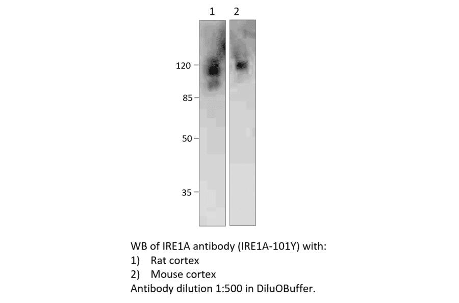 Anti-IRE1A Antibody from FabGennix (IRE1A-101Y) - Antibodies.com