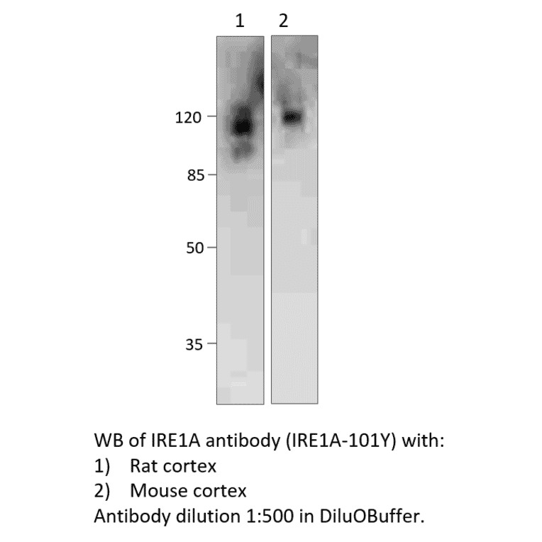 Anti-IRE1A Antibody from FabGennix (IRE1A-101Y) - Antibodies.com
