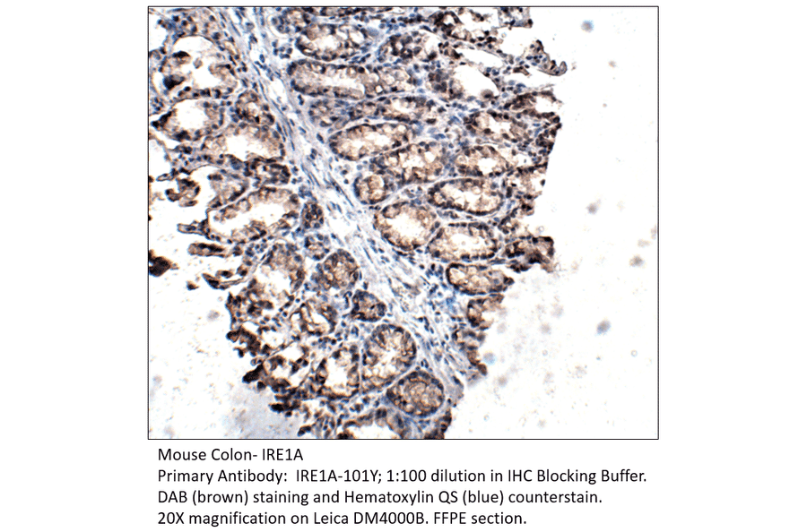 Anti-IRE1A Antibody from FabGennix (IRE1A-101Y) - Antibodies.com