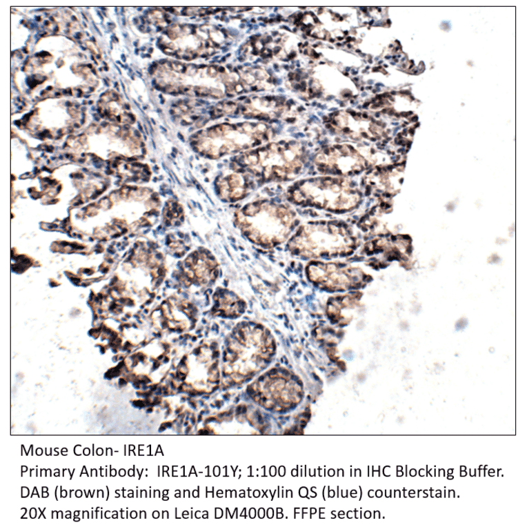 Anti-IRE1A Antibody from FabGennix (IRE1A-101Y) - Antibodies.com