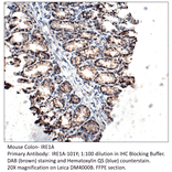 Anti-IRE1A Antibody from FabGennix (IRE1A-101Y) - Antibodies.com