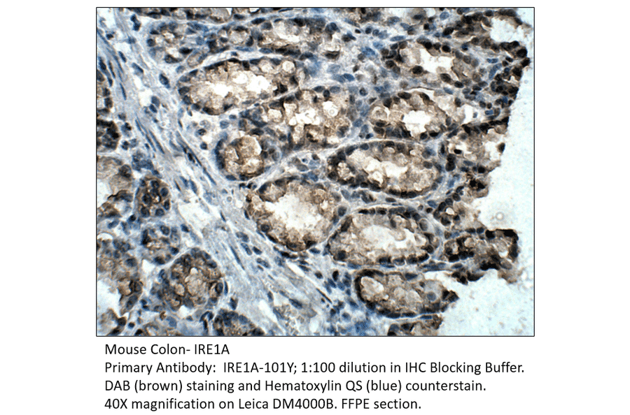 Anti-IRE1A Antibody from FabGennix (IRE1A-101Y) - Antibodies.com