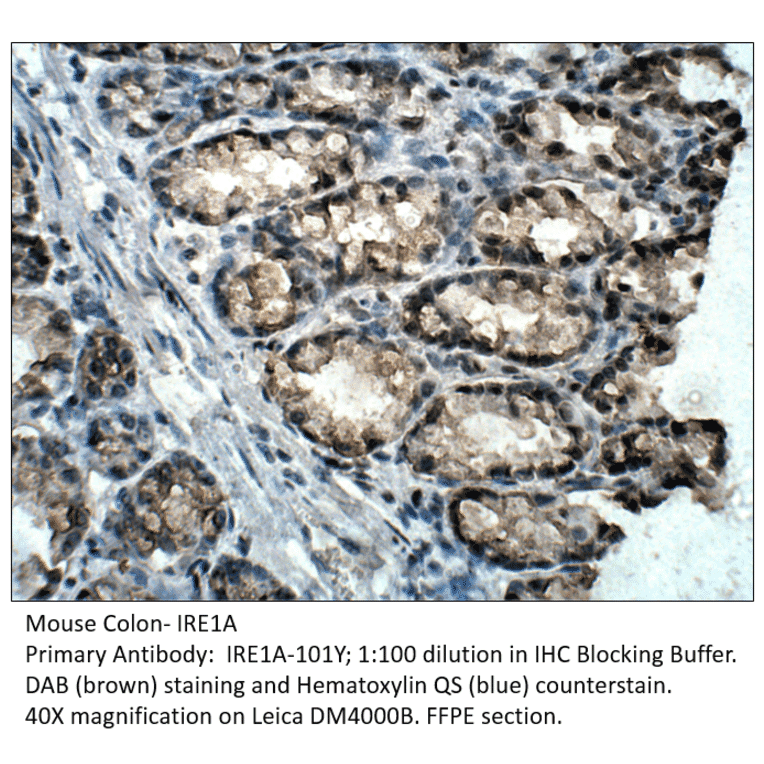 Anti-IRE1A Antibody from FabGennix (IRE1A-101Y) - Antibodies.com