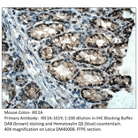 Anti-IRE1A Antibody from FabGennix (IRE1A-101Y) - Antibodies.com