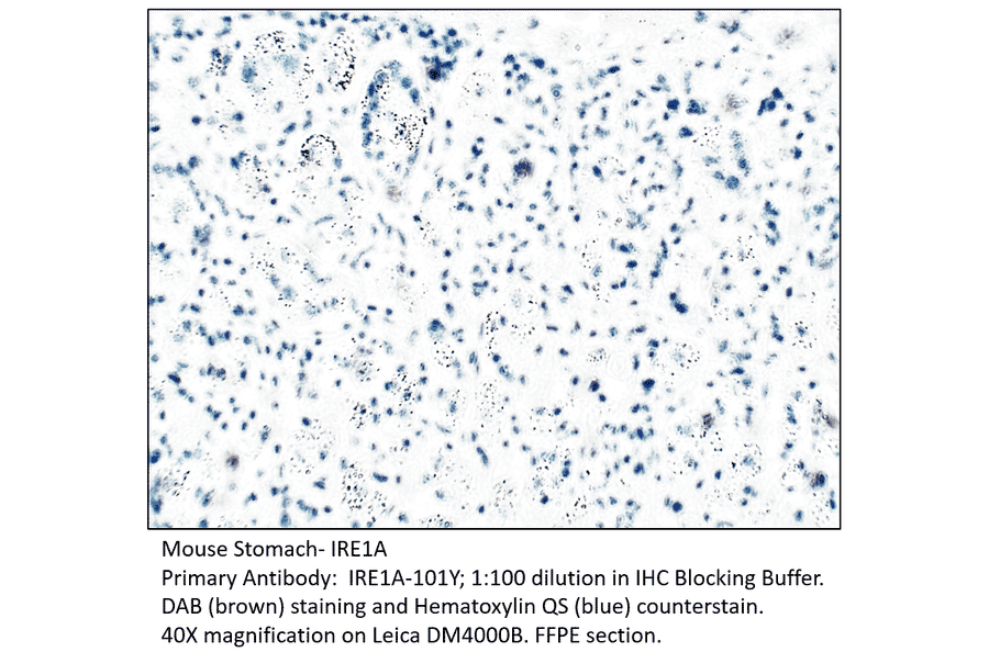 Anti-IRE1A Antibody from FabGennix (IRE1A-101Y) - Antibodies.com