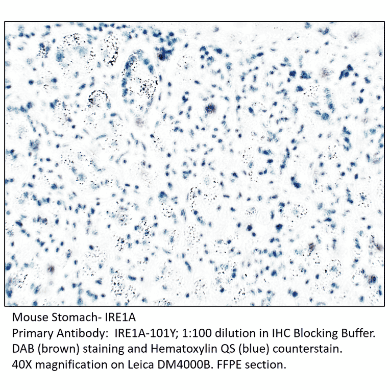 Anti-IRE1A Antibody from FabGennix (IRE1A-101Y) - Antibodies.com