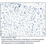 Anti-IRE1A Antibody from FabGennix (IRE1A-101Y) - Antibodies.com
