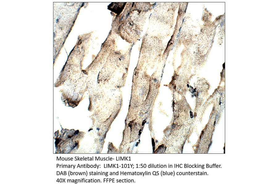 Anti-LIMK1 Antibody from FabGennix (LIMK1-101Y) - Antibodies.com