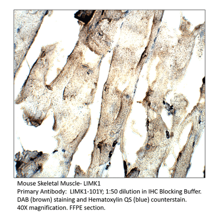 Anti-LIMK1 Antibody from FabGennix (LIMK1-101Y) - Antibodies.com