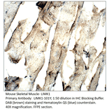 Anti-LIMK1 Antibody from FabGennix (LIMK1-101Y) - Antibodies.com