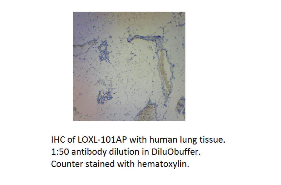 Anti-LOXL1 Antibody from FabGennix (LOXL-101AP) - Antibodies.com