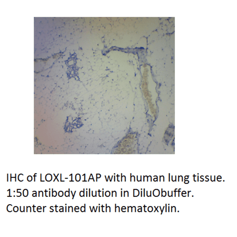 Anti-LOXL1 Antibody from FabGennix (LOXL-101AP) - Antibodies.com