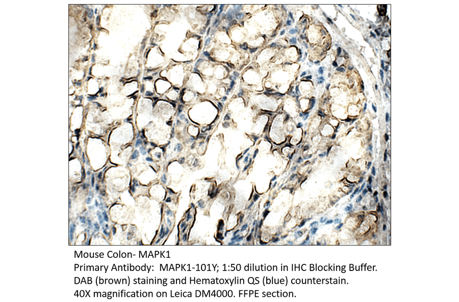 Anti-MAPK1 Antibody from FabGennix (MAPK1-101Y) - Antibodies.com