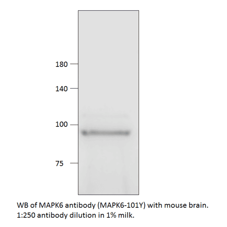 Anti-MAPK6 Antibody from FabGennix (MAPK6-101Y) - Antibodies.com