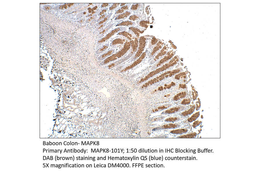 Anti-MAPK8 Antibody from FabGennix (MAPK8-101Y) - Antibodies.com