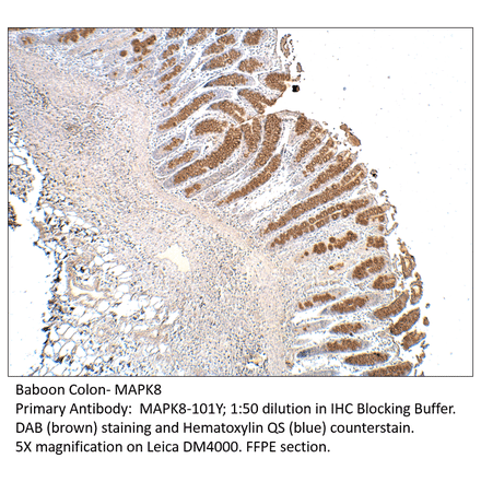 Anti-MAPK8 Antibody from FabGennix (MAPK8-101Y) - Antibodies.com
