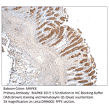 Anti-MAPK8 Antibody from FabGennix (MAPK8-101Y) - Antibodies.com