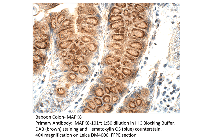 Anti-MAPK8 Antibody from FabGennix (MAPK8-101Y) - Antibodies.com