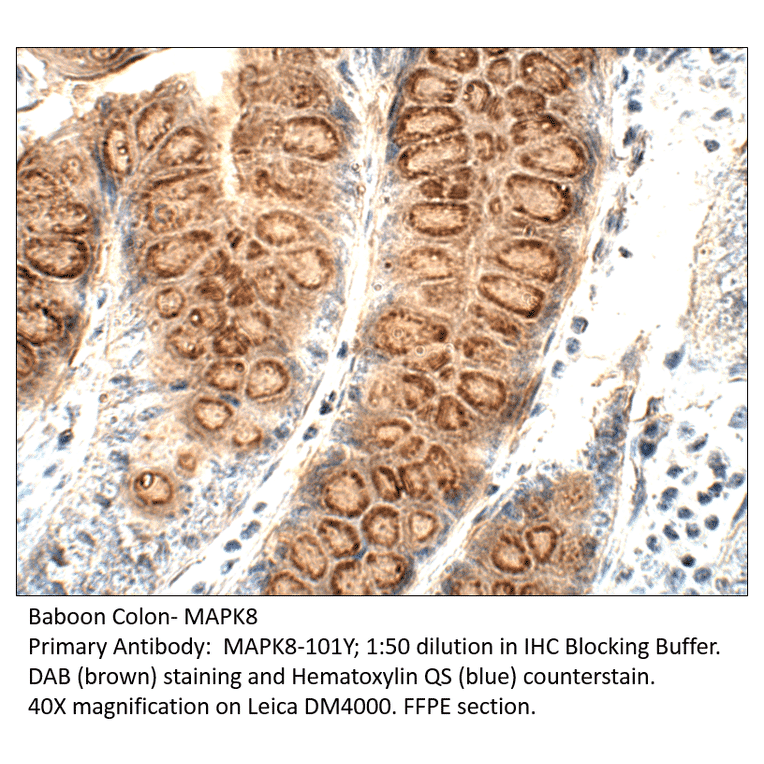 Anti-MAPK8 Antibody from FabGennix (MAPK8-101Y) - Antibodies.com