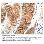 Anti-MAPK8 Antibody from FabGennix (MAPK8-101Y) - Antibodies.com