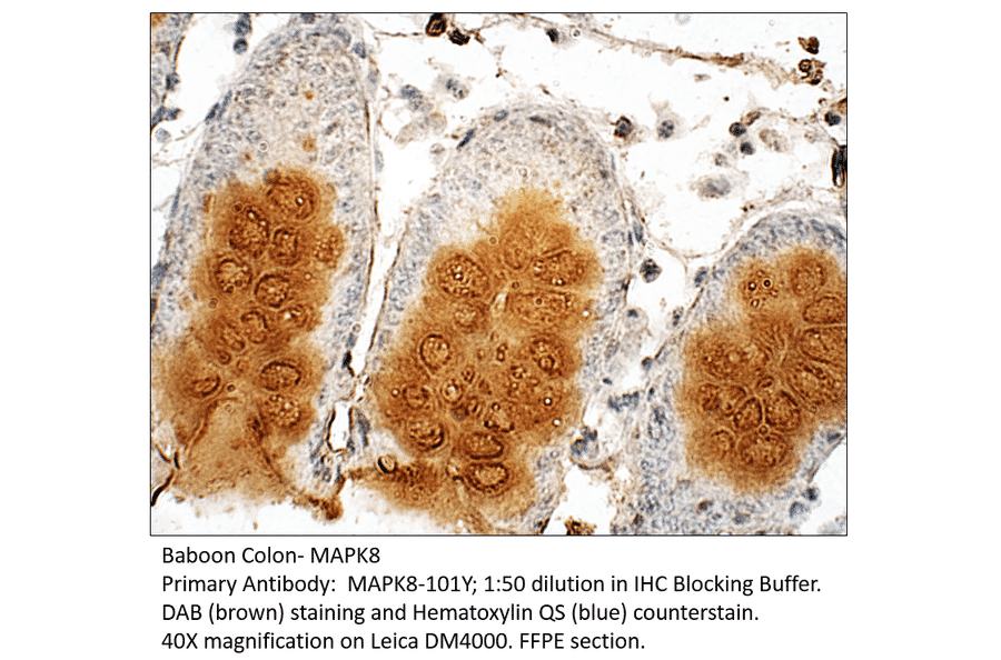 Anti-MAPK8 Antibody from FabGennix (MAPK8-101Y) - Antibodies.com