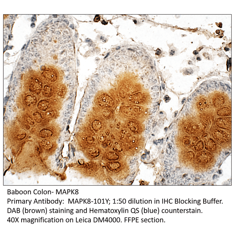 Anti-MAPK8 Antibody from FabGennix (MAPK8-101Y) - Antibodies.com