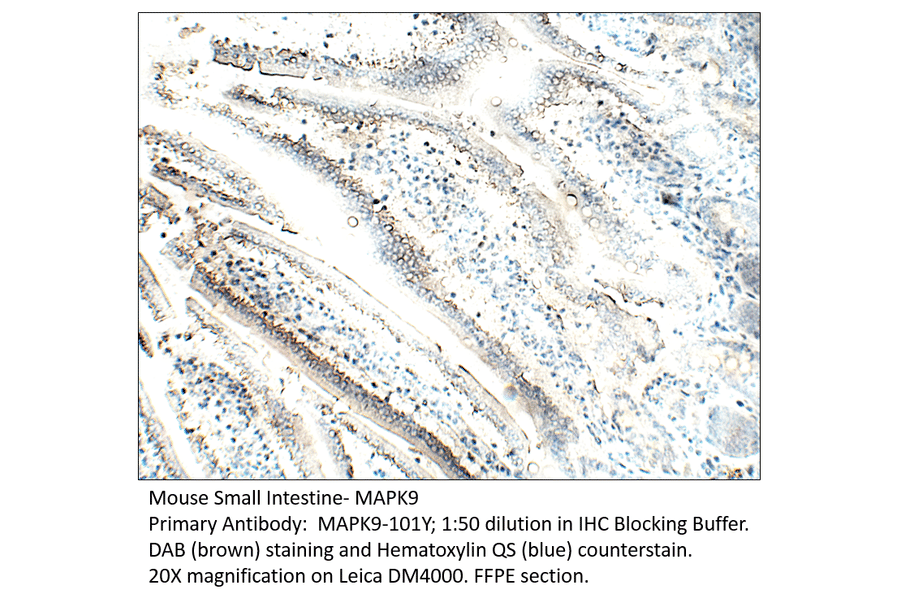 Anti-MAPK9 Antibody from FabGennix (MAPK9-101Y) - Antibodies.com