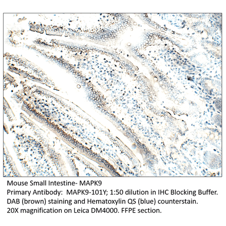Anti-MAPK9 Antibody from FabGennix (MAPK9-101Y) - Antibodies.com