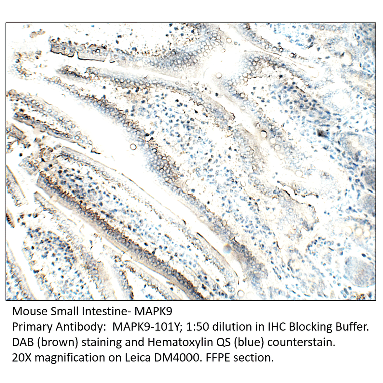 Anti-MAPK9 Antibody from FabGennix (MAPK9-101Y) - Antibodies.com