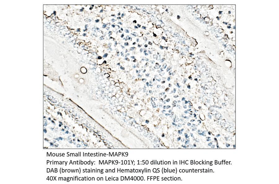 Anti-MAPK9 Antibody from FabGennix (MAPK9-101Y) - Antibodies.com