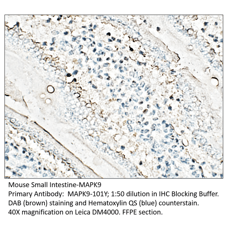 Anti-MAPK9 Antibody from FabGennix (MAPK9-101Y) - Antibodies.com