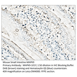 Anti-MAPK9 Antibody from FabGennix (MAPK9-101Y) - Antibodies.com