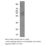 Anti-PARD3 Antibody from FabGennix (PAR3-301AP) - Antibodies.com