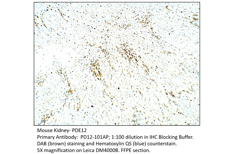Anti-PDE12 Antibody from FabGennix (PD12-101AP) - Antibodies.com