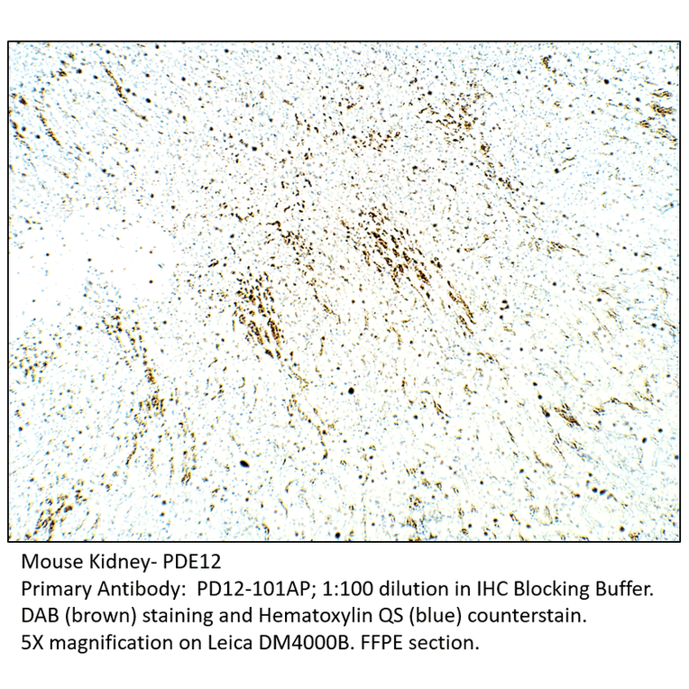 Anti-PDE12 Antibody from FabGennix (PD12-101AP) - Antibodies.com