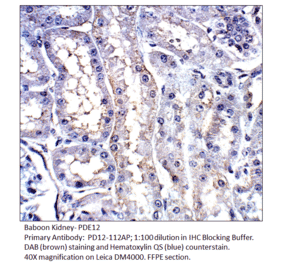 Anti-PDE12 Antibody from FabGennix (PD12-112AP) - Antibodies.com