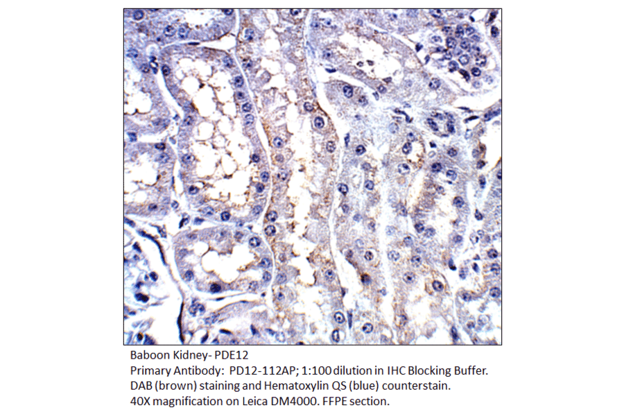 Anti-PDE12 Antibody from FabGennix (PD12-112AP) - Antibodies.com