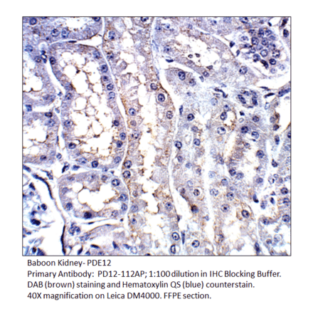 Anti-PDE12 Antibody from FabGennix (PD12-112AP) - Antibodies.com