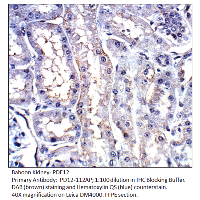 Anti-PDE12 Antibody from FabGennix (PD12-112AP) - Antibodies.com