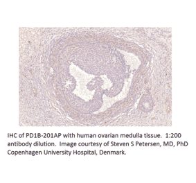 Anti-PDE1B Antibody from FabGennix (PD1B-201AP) - Antibodies.com
