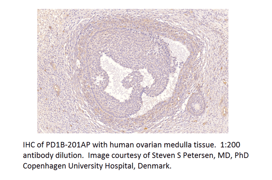 Anti-PDE1B Antibody from FabGennix (PD1B-201AP) - Antibodies.com