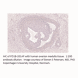 Anti-PDE1B Antibody from FabGennix (PD1B-201AP) - Antibodies.com