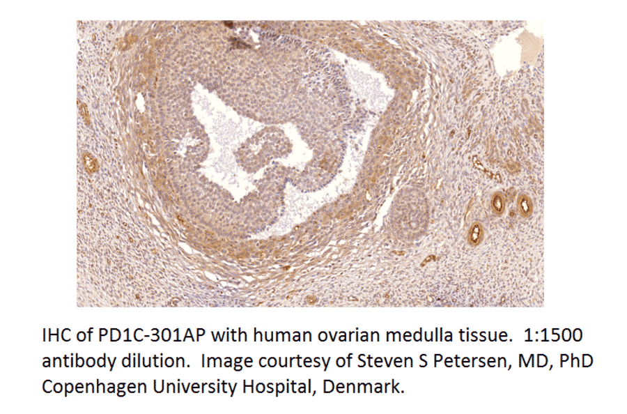 Anti-PDE1C Antibody from FabGennix (PD1C-301AP) - Antibodies.com