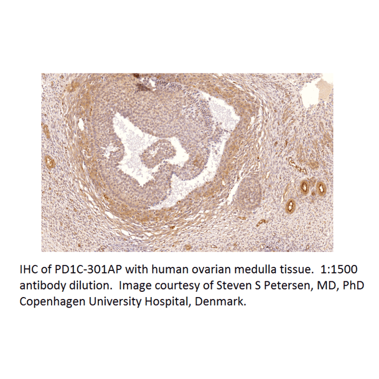 Anti-PDE1C Antibody from FabGennix (PD1C-301AP) - Antibodies.com