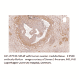 Anti-PDE1C Antibody from FabGennix (PD1C-301AP) - Antibodies.com