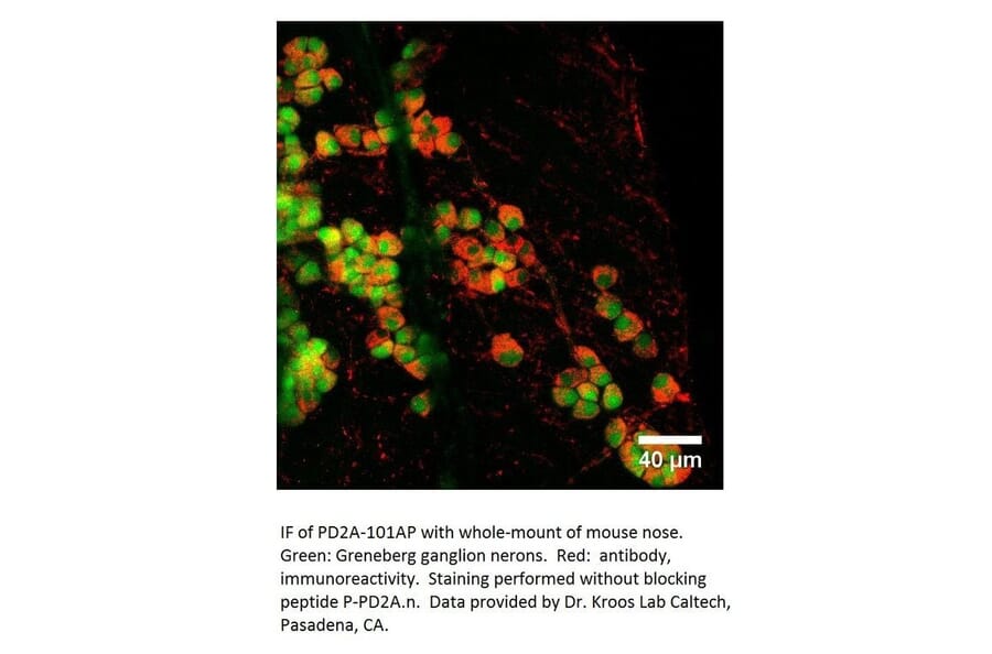 Anti-PDE2A Antibody from FabGennix (PD2A-101AP) - Antibodies.com