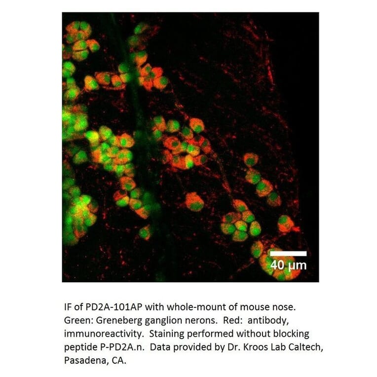Anti-PDE2A Antibody from FabGennix (PD2A-101AP) - Antibodies.com