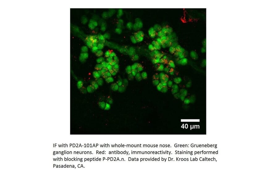 Anti-PDE2A Antibody from FabGennix (PD2A-101AP) - Antibodies.com